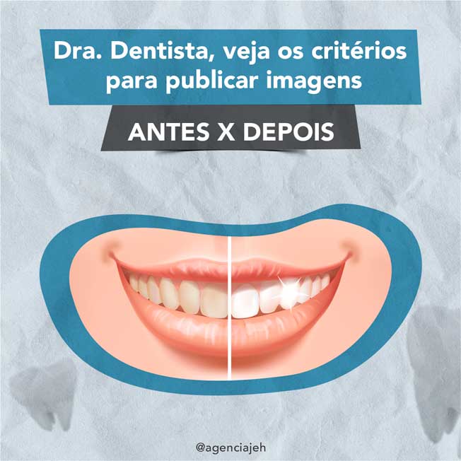 Imagens de tratamento odontológico ANTES x DEPOIS